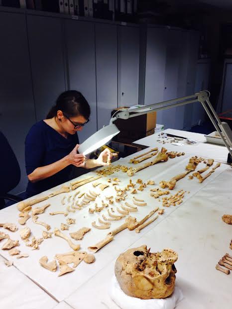 Michaela Binder mentre analizza lo scheletro con tumore alle ossa