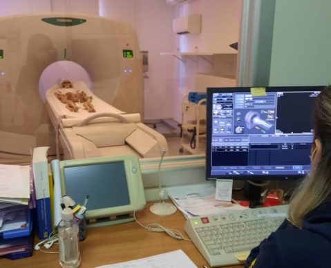 jesolo_area-archeologica-antiche-mura_monastero-san-mauro_campagna-2023_scheletro-con-osteocondromi_tac_foto-unive